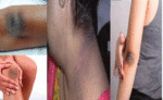 गर्दन और कोहनी के कालेपन ने छीन लिया है चेहरे का निखार, तो ये 3 नुस्खे होंगे असरदार